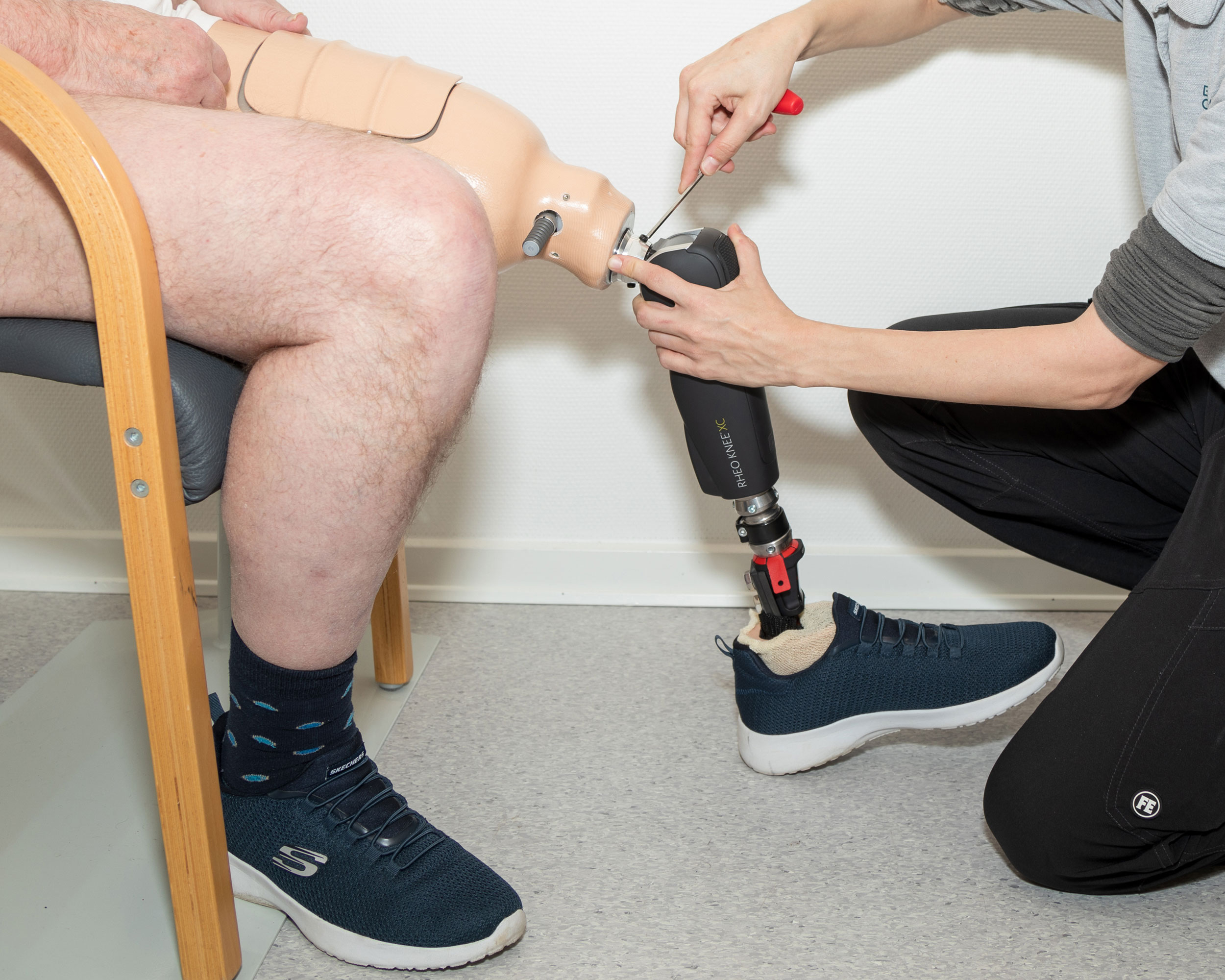 Amputation Amputation