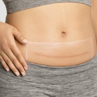 Squares Silicone Scar Plaster. Velegnet efter fx kejsersnit