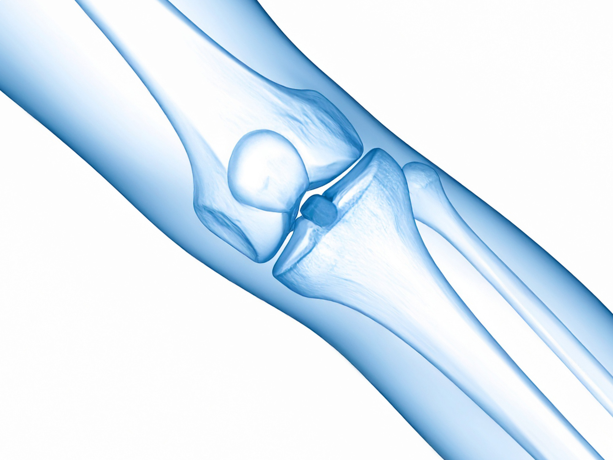 Knæex-SEO-midlertidig Knæex
