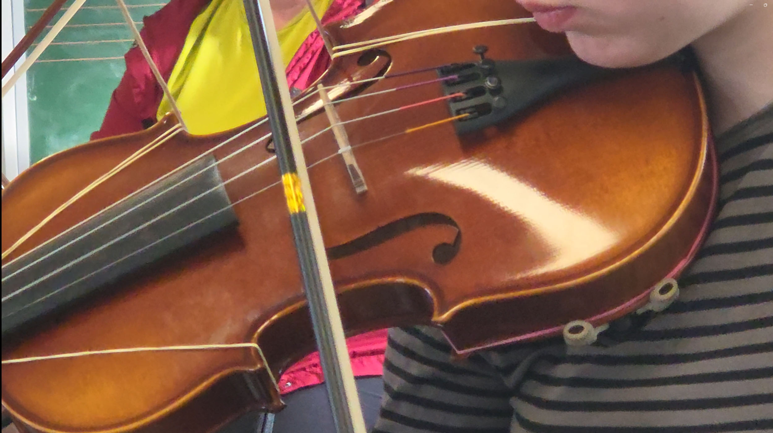 Violinbueprotese-4-small Samspil med violinbueprotese