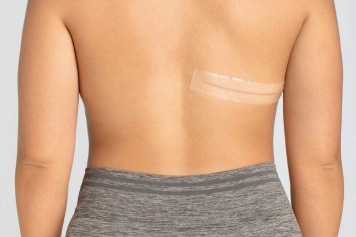 CuraScar silikoneplaster