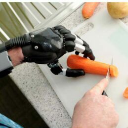 Elektrisk delhåndsprotese