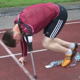 Overarmsprotese i kulfiber til løb