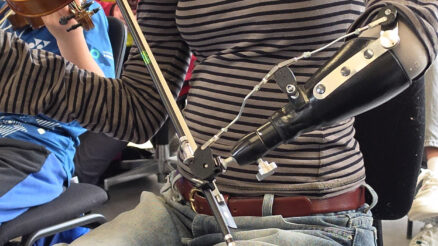 Frida violinbueprotese